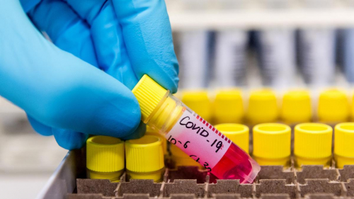 На борьбу с COVID-19 в США сокращают финансирование: 23 штата подали в суд на администрацию Трампа